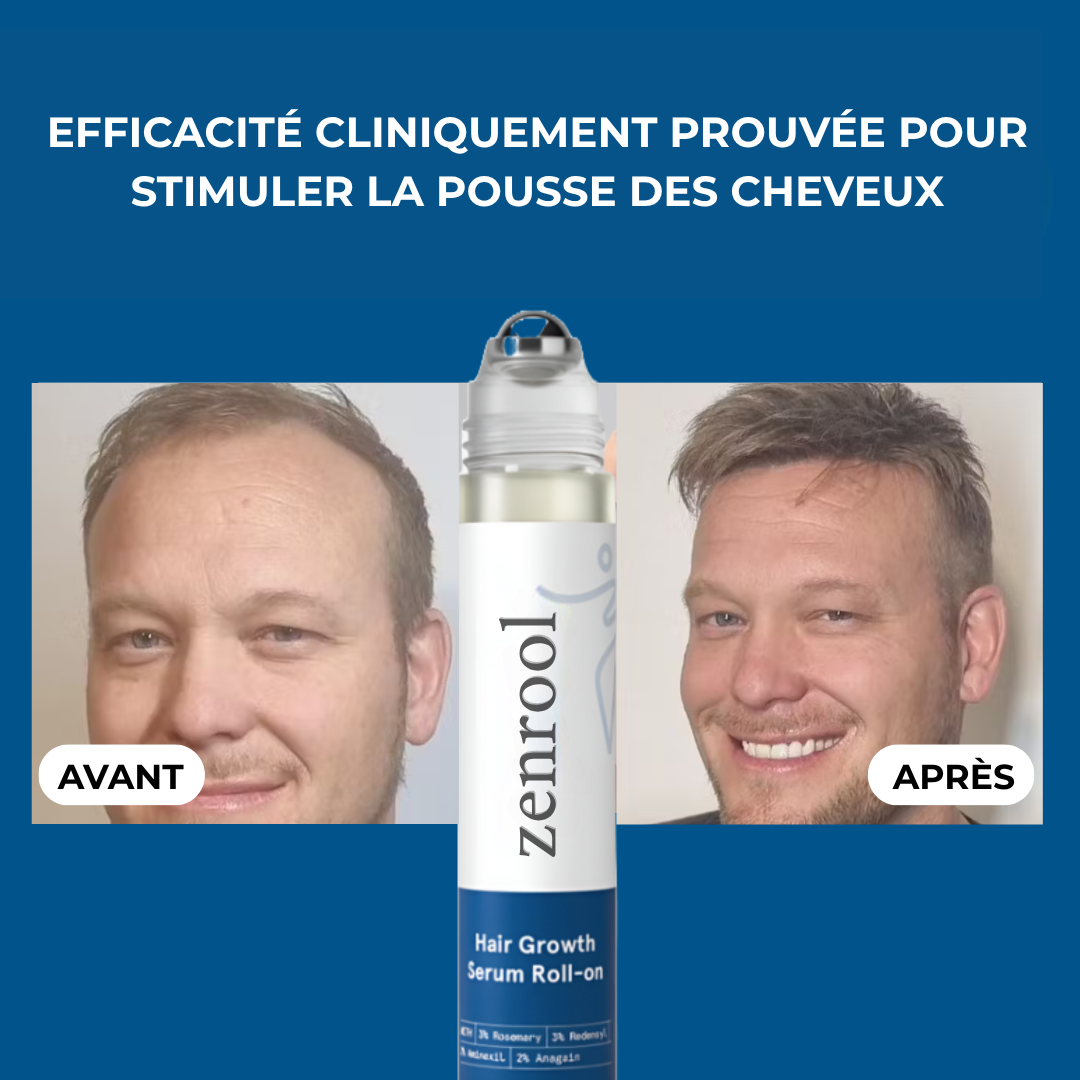 Sérum Roll-On Anti-Chute et Repousse