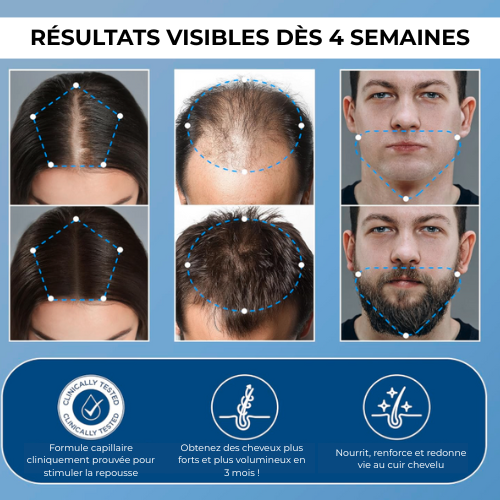 Sérum Roll-On Anti-Chute et Repousse