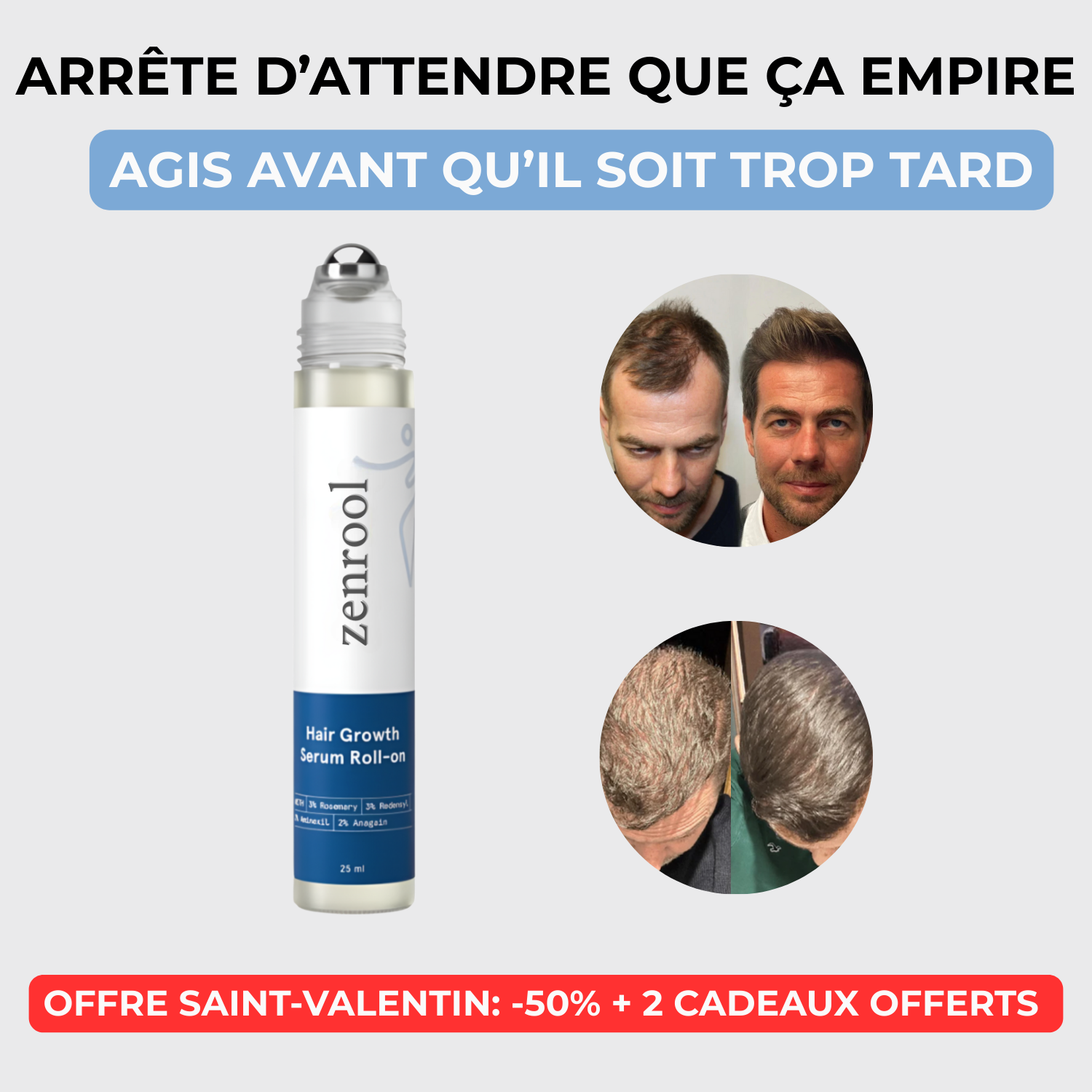 Sérum Roll-On Anti-Chute et Repousse